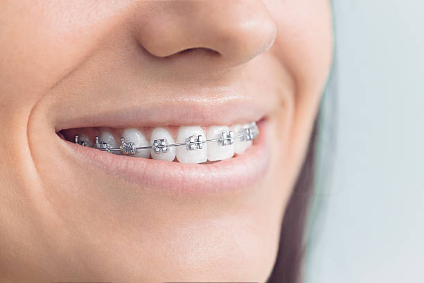 Best Teeth Whitening  in Brier, WA